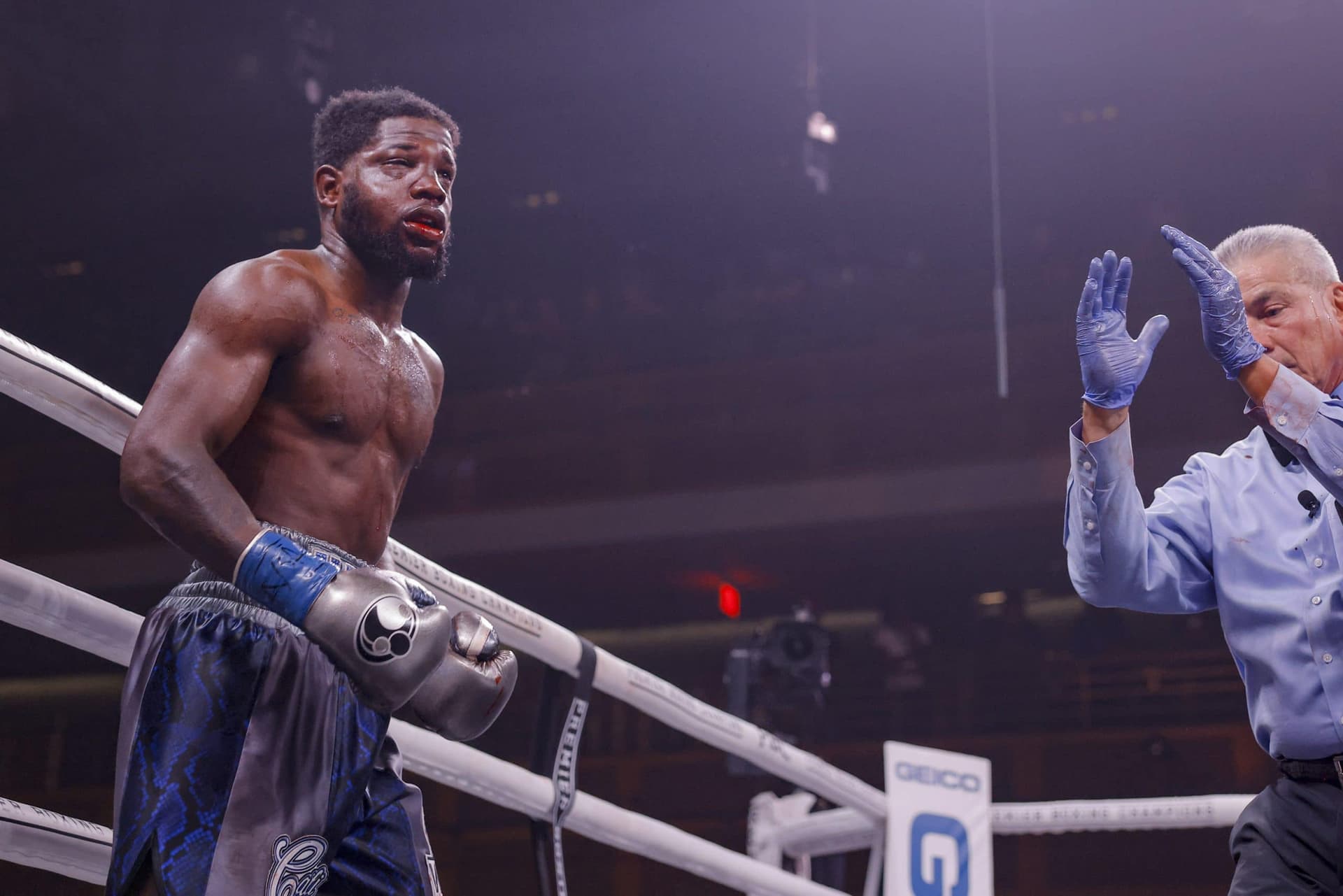 PHOTOS: Boxer's Face Became Brutally Disfigured After Fight Of The Year Candidate